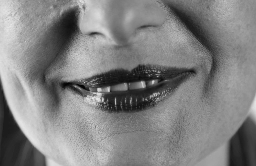 dokter nadine - neuslippenplooi